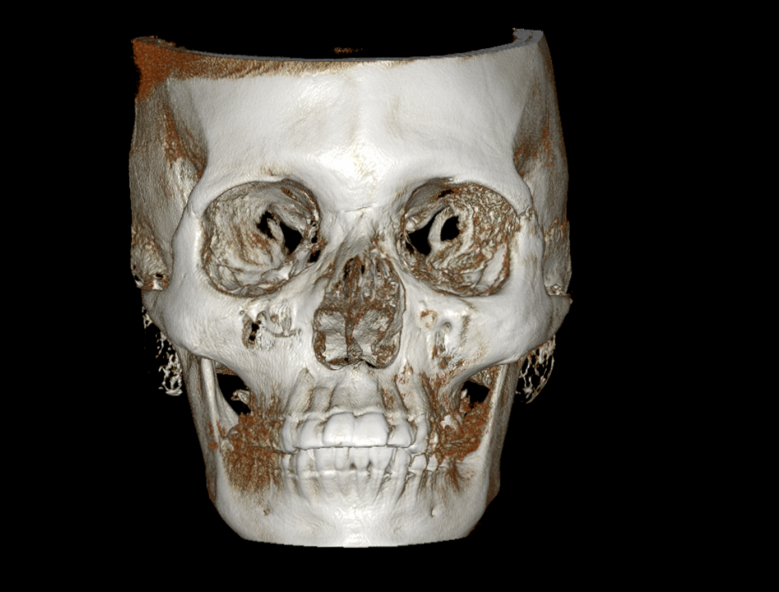 Visor de Tomografía 3D Interactivo